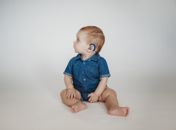 Infant sitting on floor showing hearing aid on left ear